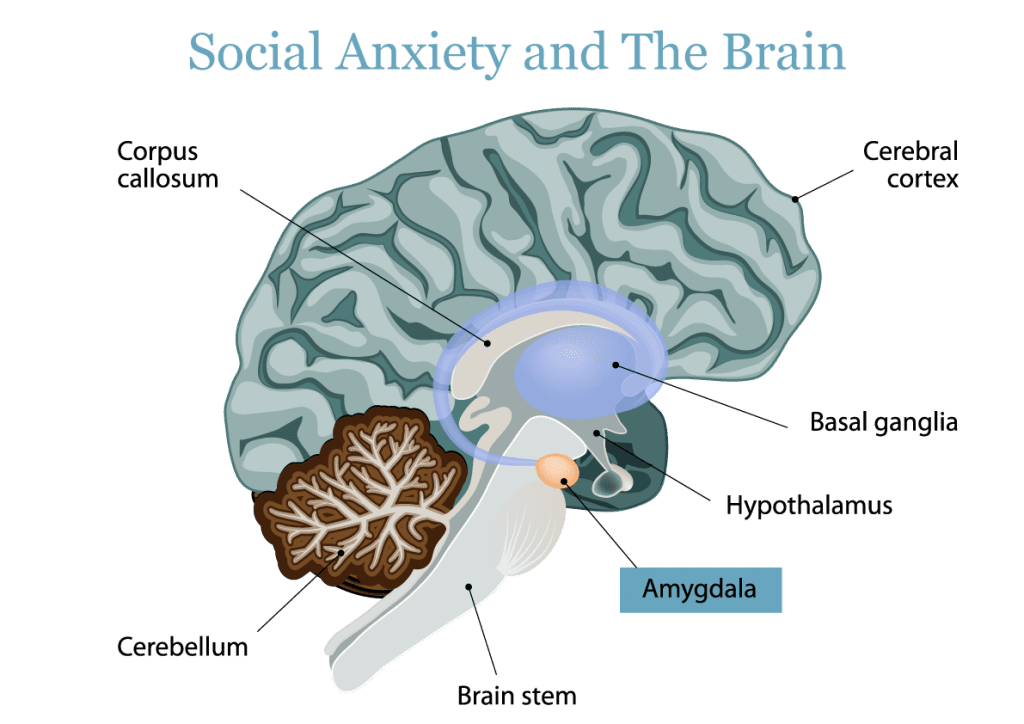 anxiety disorder brain